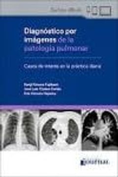 portada Diagnóstico por Imágenes de la Patología Pulmonar. Casos de Interés en la Práctica Diaria