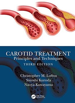 portada Carotid Treatment: Principles and Techniques (in English)