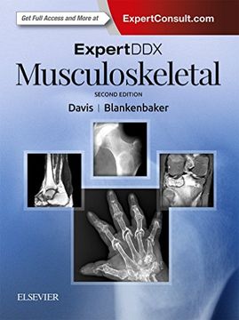 portada Expertddx: Musculoskeletal, 2e (en Inglés)