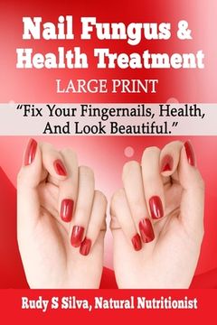 portada Nail Fungus and Health Treatment: Large Print: Fix Your Fingernail's Health And Look Beautiful (en Inglés)