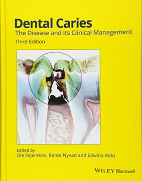 portada Dental Caries: The Disease and its Clinical Management (en Inglés)