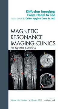 portada Clinical Applications of Diffusion Imaging: From Head to Toe, an Issue of Magnetic Resonance Imaging Clinics: Volume 19-1 (in English)