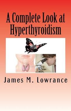 portada a complete look at hyperthyroidism (en Inglés)