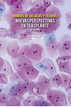 portada Nuevas Perspectivas en Transplante - 2ª Edición
