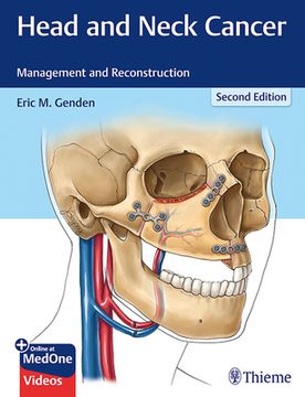 portada Head and Neck Cancer: Management and Reconstruction (in English)