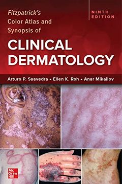 portada Fitzpatrick's Color Atlas and Synopsis of Clinical Dermatology, Ninth Edition (in English)