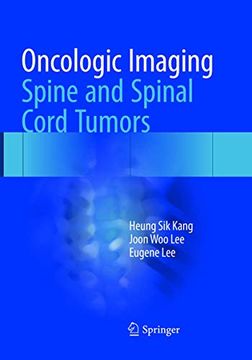 portada Oncologic Imaging: Spine and Spinal Cord Tumors