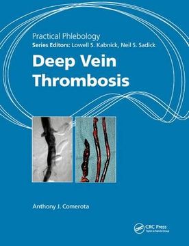 portada Deep Vein Thrombosis (in English)