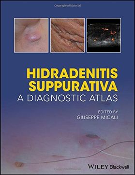portada Hidradenitis Suppurativa: A Diagnostic Atlas