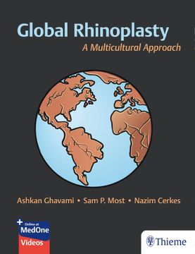 portada Global Rhinoplasty: A Multicultural Approach (en Inglés)