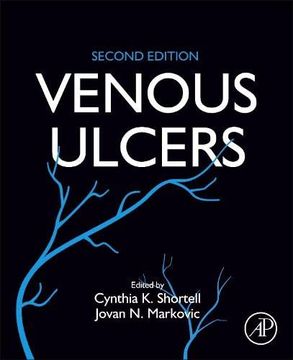 portada Venous Ulcers (in English)