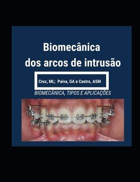 portada Biomecânica dos Arcos de Intrusão (en Portugués)