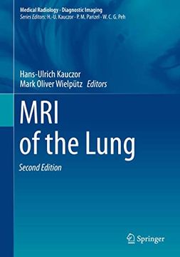 portada MRI of the Lung (in English)