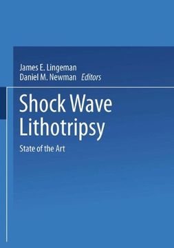 portada Shock Wave Lithotripsy: State Of The Art