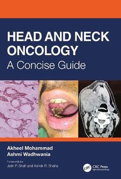 portada Head and Neck Oncology: A Concise Guide (en Inglés)