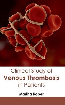 portada Clinical Study of Venous Thrombosis in Patients (en Inglés)