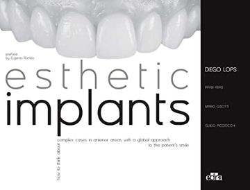 portada Esthetic Implants. How to Think About Complex Cases in Anterior Areas With a Global Approach to the Patient Smile (in English)