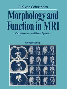 portada morphology and function in mri: cardiovascular and renal systems (en Inglés)