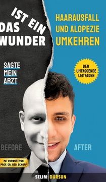 portada Das Ist Ein Wunder Sagte Mein Arzt: Haarverlust Und Alopezie Umkehren (en Alemán)