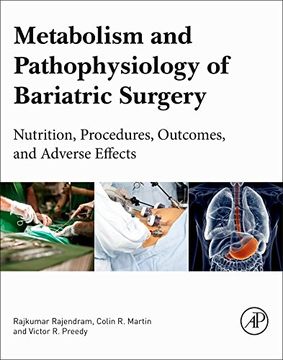 portada Metabolism and Pathophysiology of Bariatric Surgery: Nutrition, Procedures, Outcomes and Adverse Effects (in English)