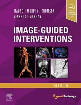 portada Image-Guided Interventions: Expert Radiology Series 