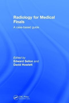 portada Radiology for Medical Finals: A Case-Based Guide (en Inglés)