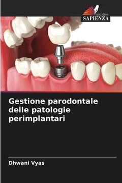portada Gestione parodontale delle patologie perimplantari (in Italian)