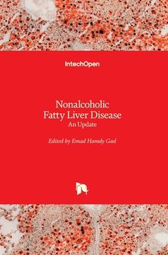 portada Nonalcoholic Fatty Liver Disease: An Update (en Inglés)