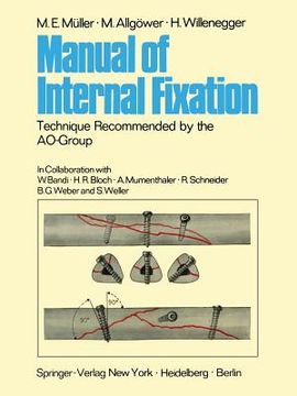 portada manual of internal fixation: technique recommended by the ao-group swiss association for the study of internal fixation: asif (en Inglés)