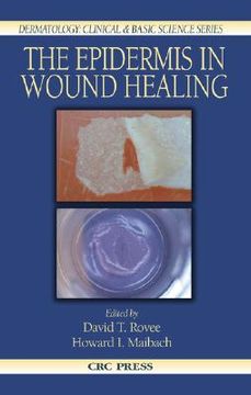 portada the epidermis in wound healing (en Inglés)