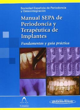 portada Manual Sepa de Periodoncia y TerapEutica de Implantes (in Spanish)