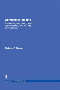 portada Ophthalmic Imaging: Posterior Segment Imaging, Anterior Eye Photography, and Slit Lamp Biomicrography (en Inglés)