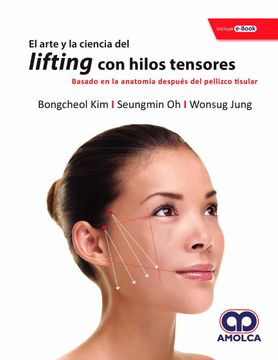 portada El Arte y la Ciencia del Lifting con Hilos Tensores. Basado en la Anatomia Despues del Pellizco Tisular + E-Book