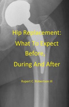 portada Hip Replacement: What To Expect Before, During and After (en Inglés)