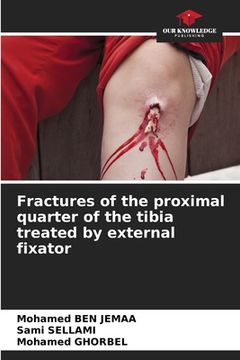 portada Fractures of the proximal quarter of the tibia treated by external fixator (in English)