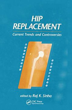 portada Hip Replacement: Current Trends and Controversies (en Inglés)