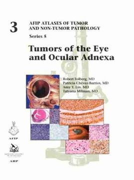 portada Tumors of the eye and Ocular Adnexa (Afip Atlas of Tumor and Non-Tumor Pathology, Series 5) (en Inglés)