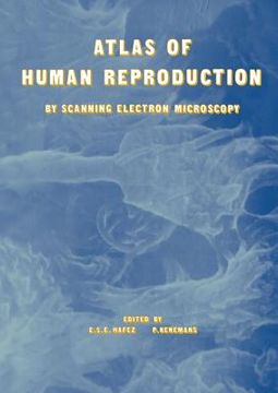portada Atlas of Human Reproduction: By Scanning Electron Microscopy (en Inglés)