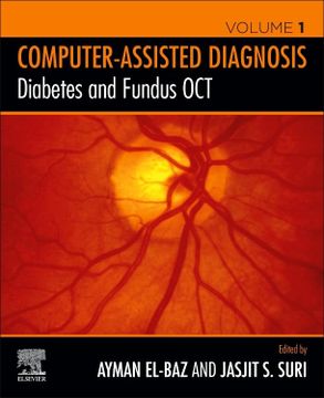 portada Diabetes and Fundus oct (Computer-Assisted Diagnosis) (en Inglés)