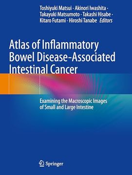portada Atlas of Inflammatory Bowel Disease-Associated Intestinal Cancer: Examining the Macroscopic Images of Small and Large Intestine (en Inglés)