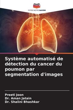 portada Système automatisé de détection du cancer du poumon par segmentation d'images (en Francés)