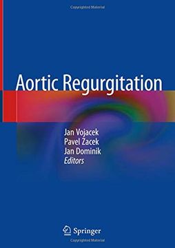 portada Aortic Regurgitation (en Inglés)