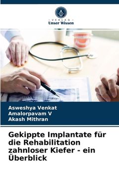 portada Gekippte Implantate für die Rehabilitation zahnloser Kiefer - ein Überblick (en Alemán)