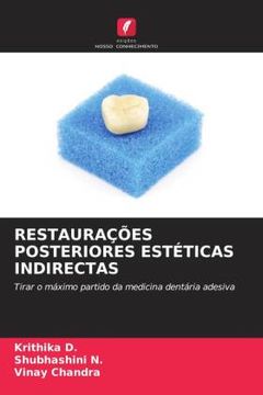 portada Restauraã â ã â es Posteriores Estã â Ticas Indirectas