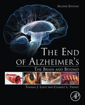portada The end of Alzheimer’S: The Brain and Beyond (en Inglés)