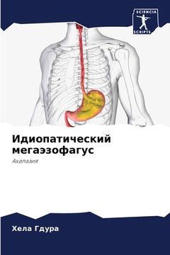 portada Идиопатический мегаэзо&# (in Russian)