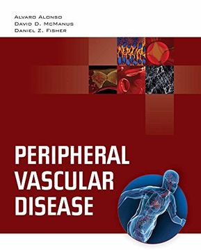 portada Peripheral Vascular Disease (en Inglés)
