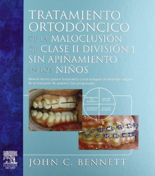 portada Tratamiento Ortodóncico de la Maloclusión Clase ii División 1 sin Apiñamiento en los Niños (in Spanish)
