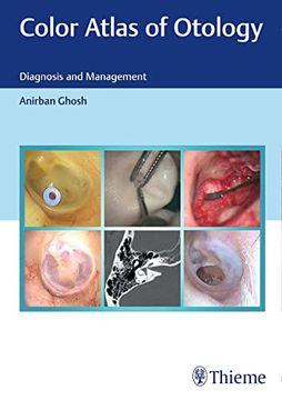 portada Color Atlas of Otology: Diagnosis and Management (en Inglés)