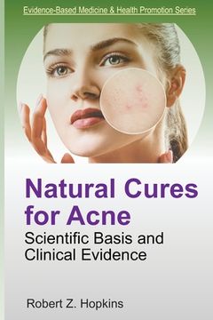 portada Natural Cures for Acne: Scientific Basis and Clinical Evidence (en Inglés)
